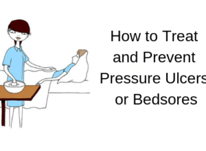 How-to-Treat-and-Prevent-Pressure-Ulcers-or-Bedsores