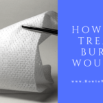 burn injury treatment